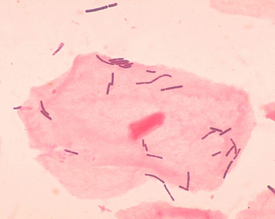 Lactobacillus acidophilus